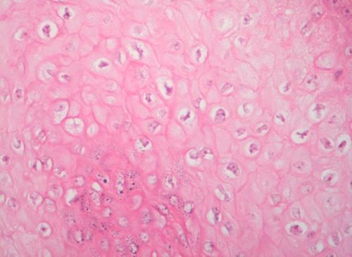 https://cdn.ncbi.nlm.nih.gov/pmc/blobs/f8c8/10473329/eab64751312d/ms9-85-4638-g006.jpg