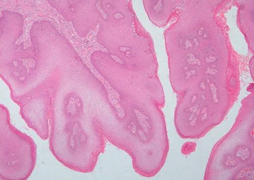 https://cdn.ncbi.nlm.nih.gov/pmc/blobs/f8c8/10473329/eb348e5b3451/ms9-85-4638-g005.jpg