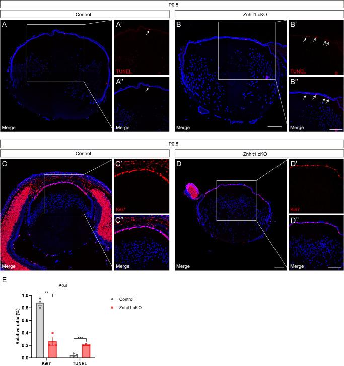 https://cdn.ncbi.nlm.nih.gov/pmc/blobs/f8ca/9055562/4ea0c7dc164b/iovs-63-4-18-f004.jpg