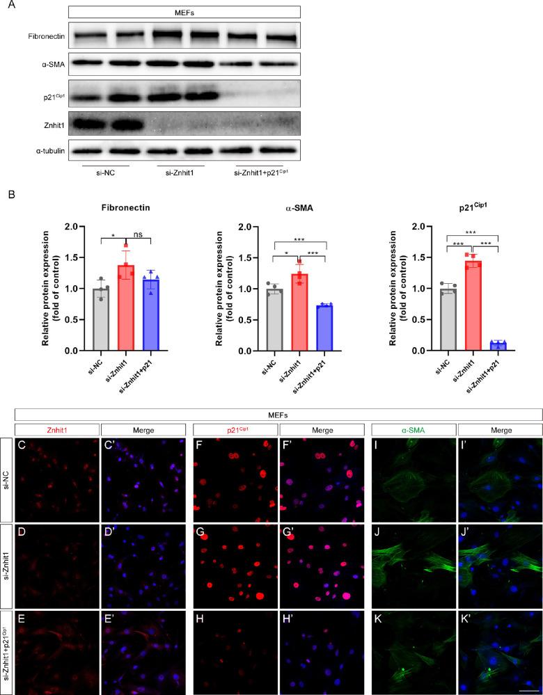 https://cdn.ncbi.nlm.nih.gov/pmc/blobs/f8ca/9055562/8e9de3ab9171/iovs-63-4-18-f010.jpg