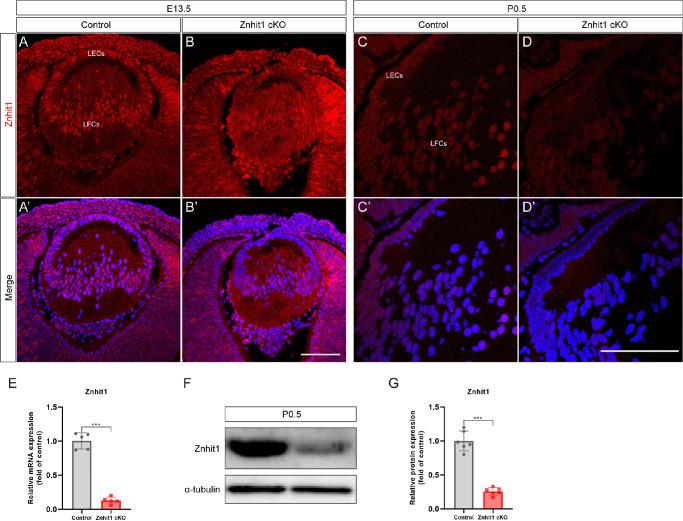 https://cdn.ncbi.nlm.nih.gov/pmc/blobs/f8ca/9055562/df9cf7d33882/iovs-63-4-18-f002.jpg