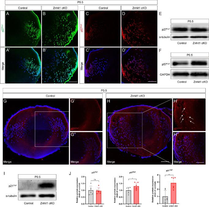 https://cdn.ncbi.nlm.nih.gov/pmc/blobs/f8ca/9055562/e9a161b3dd48/iovs-63-4-18-f008.jpg