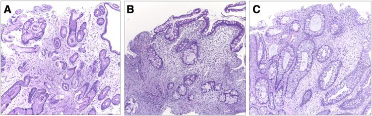 https://cdn.ncbi.nlm.nih.gov/pmc/blobs/f8cd/9578680/35fd6cb973aa/cureus-0014-00000029298-i03.jpg