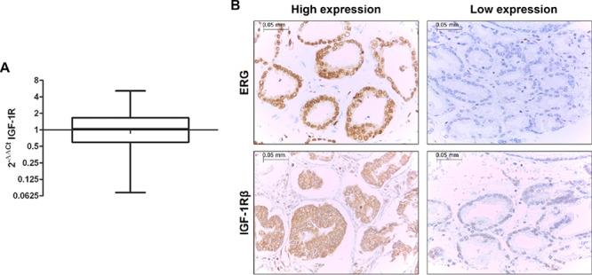 https://cdn.ncbi.nlm.nih.gov/pmc/blobs/f8ce/4599293/80b518a3b203/oncotarget-06-16611-g005.jpg