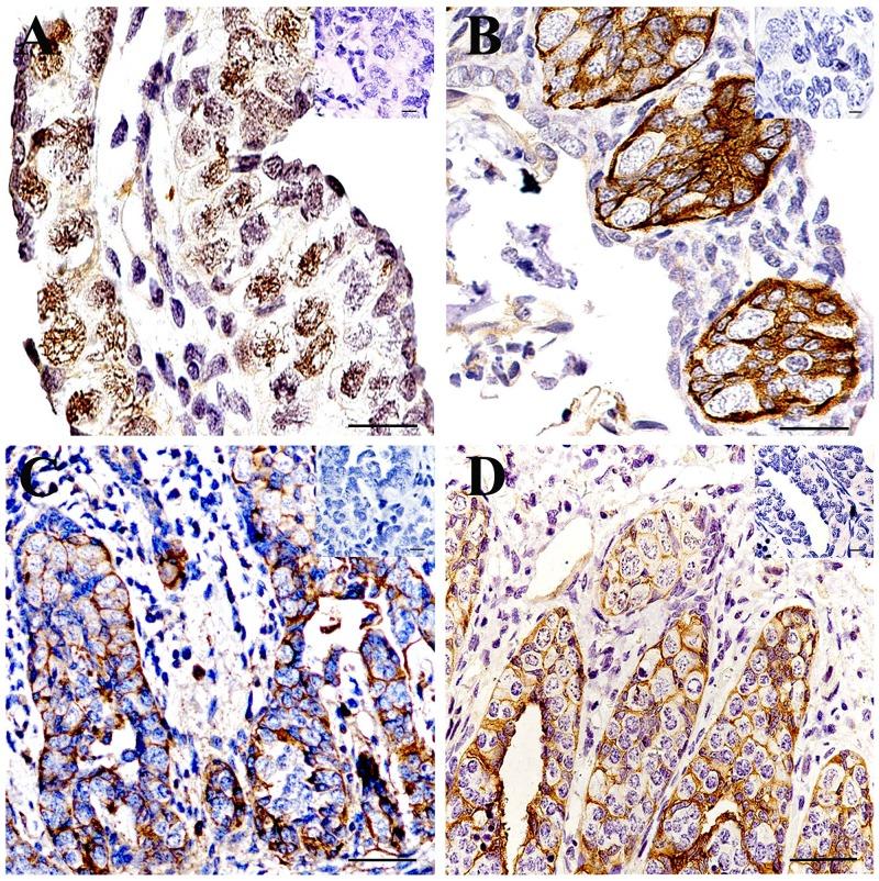 https://cdn.ncbi.nlm.nih.gov/pmc/blobs/f8ce/5689666/cc9e08ad4fec/oncotarget-08-86043-g005.jpg
