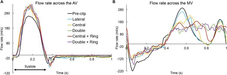 https://cdn.ncbi.nlm.nih.gov/pmc/blobs/f8ce/7221026/72dc191dfbe5/fphys-11-00432-g002.jpg