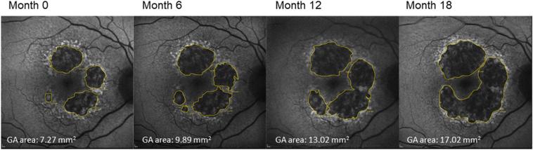 https://cdn.ncbi.nlm.nih.gov/pmc/blobs/f8d0/10810745/ca3ec8ad1496/gr2.jpg