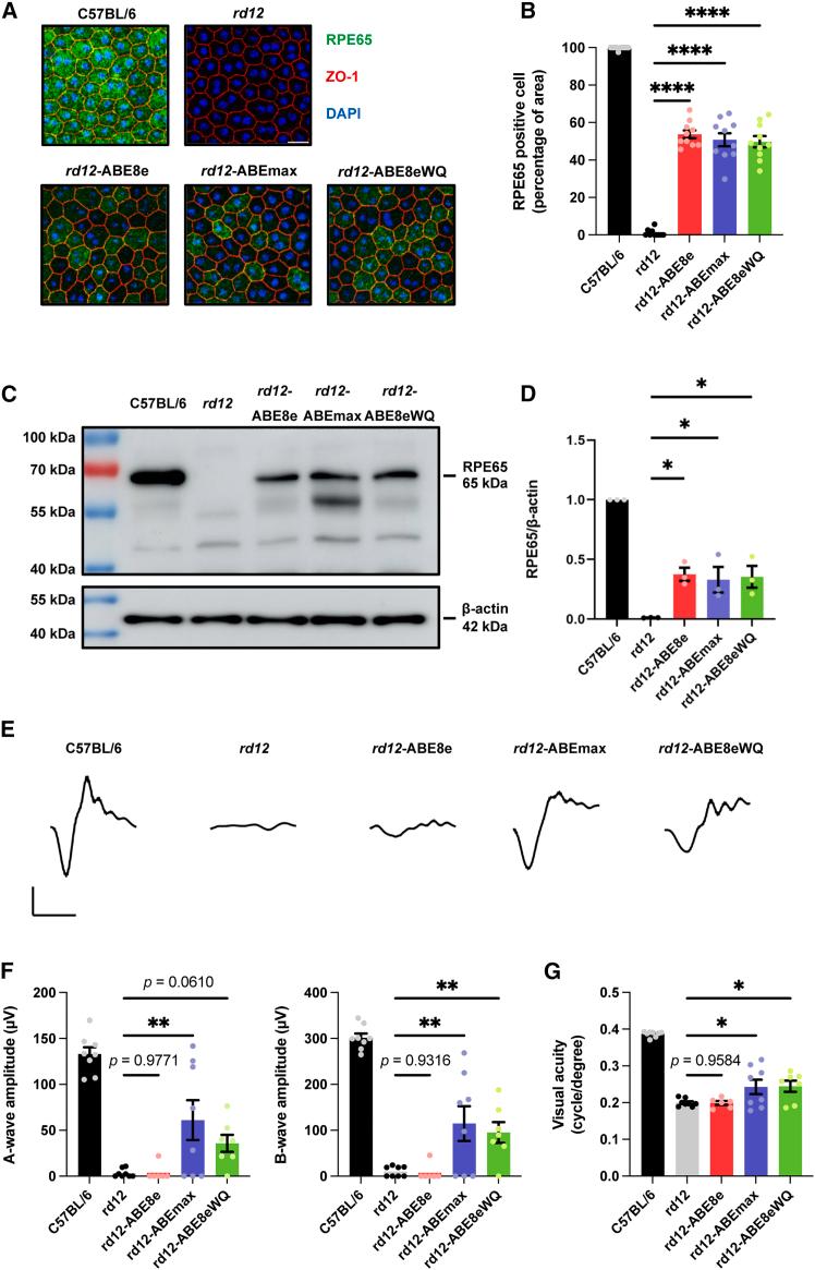 https://cdn.ncbi.nlm.nih.gov/pmc/blobs/f8d2/12032331/82e13b4cb99a/gr2.jpg