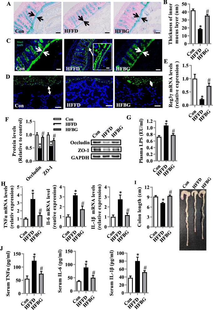 https://cdn.ncbi.nlm.nih.gov/pmc/blobs/f8d4/7532656/b6bc370e7e49/40168_2020_920_Fig4_HTML.jpg