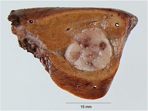 https://cdn.ncbi.nlm.nih.gov/pmc/blobs/f8dd/4747964/05f1ae526eca/40792_2015_15_Fig4_HTML.jpg