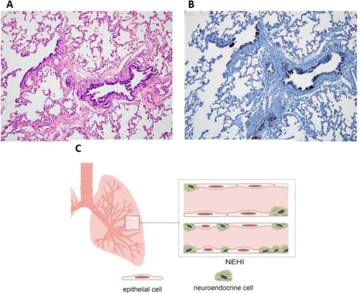 https://cdn.ncbi.nlm.nih.gov/pmc/blobs/f8de/11322232/608875e0928a/CRJ-18-e13827-g005.jpg