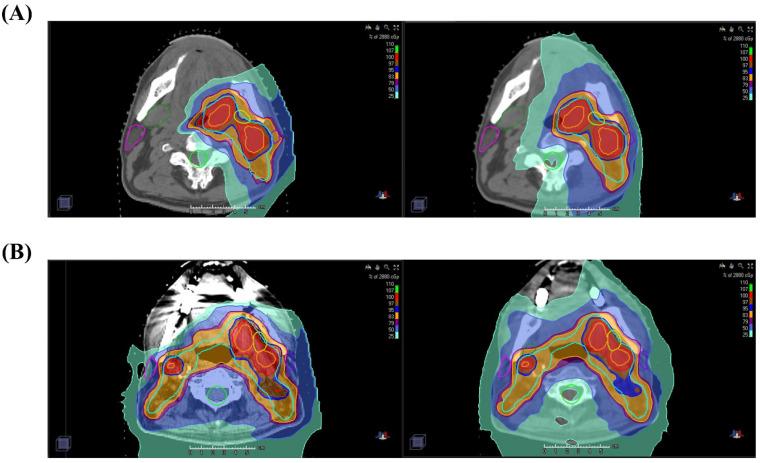 https://cdn.ncbi.nlm.nih.gov/pmc/blobs/f8e2/8037748/46ecef4553a0/cancers-13-01549-g003.jpg