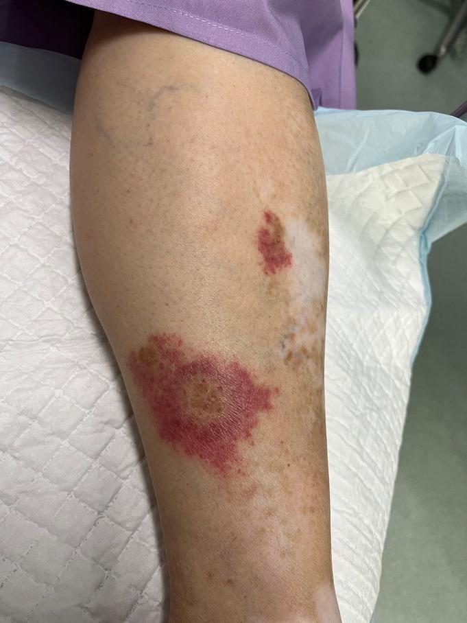 https://cdn.ncbi.nlm.nih.gov/pmc/blobs/f8e4/10918711/32f974a49ea0/CCR3-12-e8609-g002.jpg
