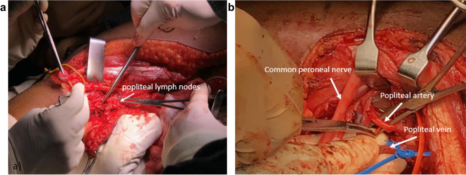 https://cdn.ncbi.nlm.nih.gov/pmc/blobs/f8ea/9454124/5d0c75faab29/12893_2022_1780_Fig7_HTML.jpg