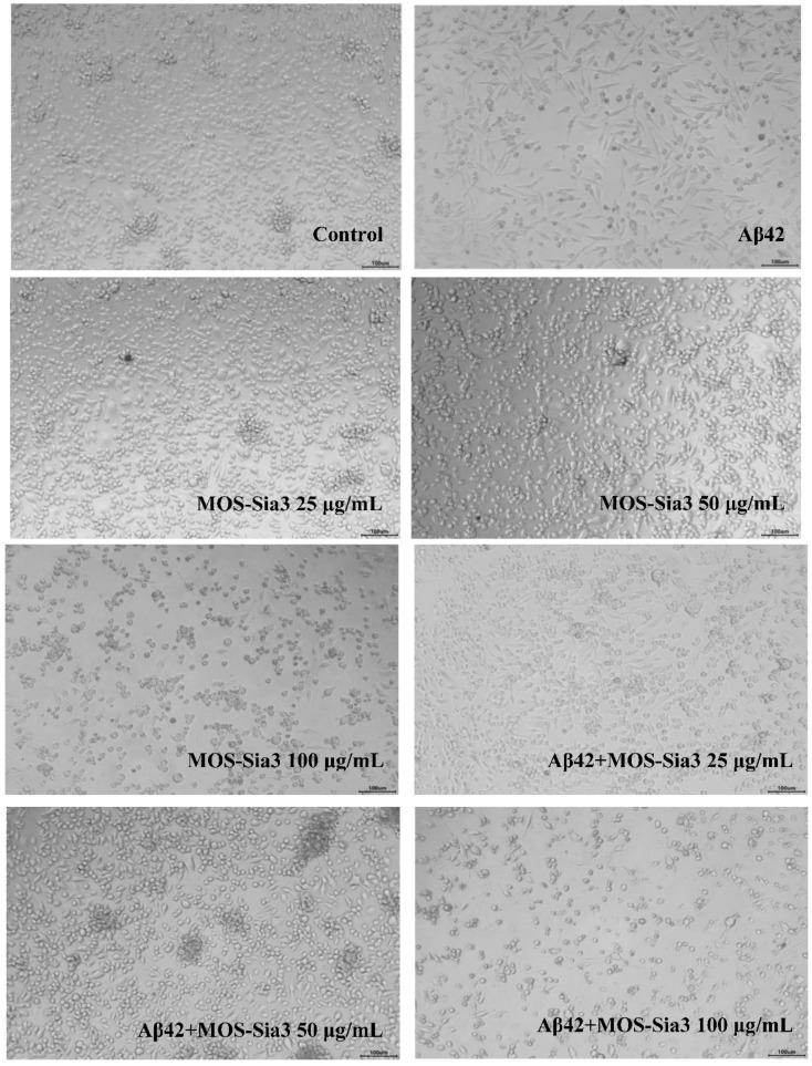 https://cdn.ncbi.nlm.nih.gov/pmc/blobs/f8f2/8621211/d21bb71b4171/ijms-22-12338-g006.jpg