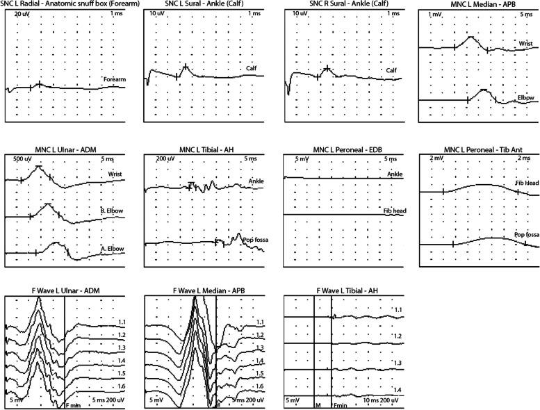 https://cdn.ncbi.nlm.nih.gov/pmc/blobs/f8f4/10675934/c99a9c3bf169/12883_2023_3471_Fig4_HTML.jpg