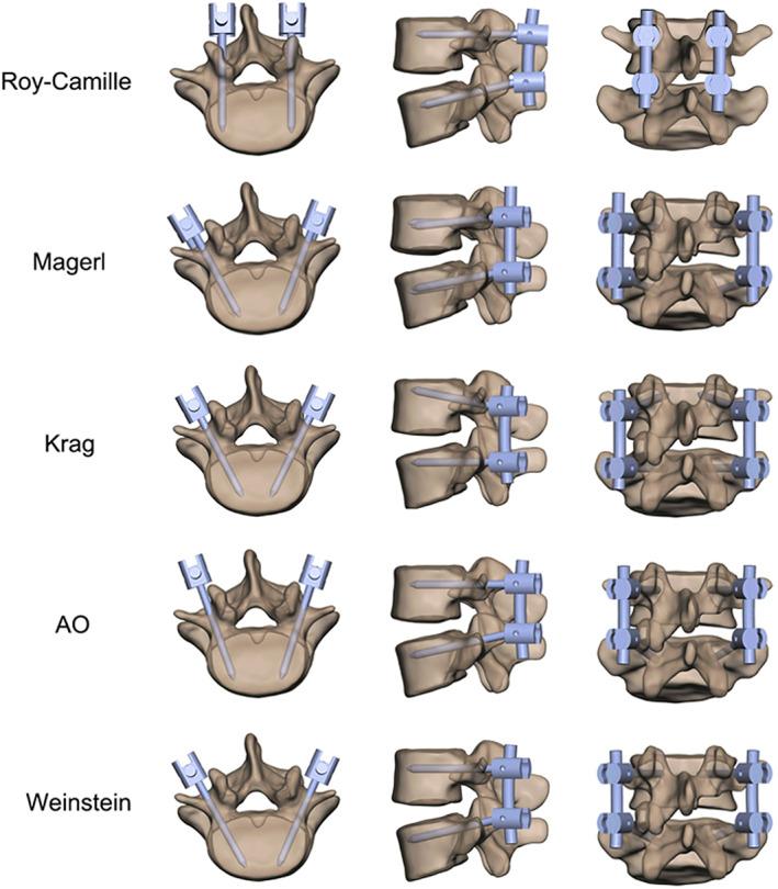 https://cdn.ncbi.nlm.nih.gov/pmc/blobs/f8fa/10102325/4216bcf000ee/OS-15-1153-g005.jpg