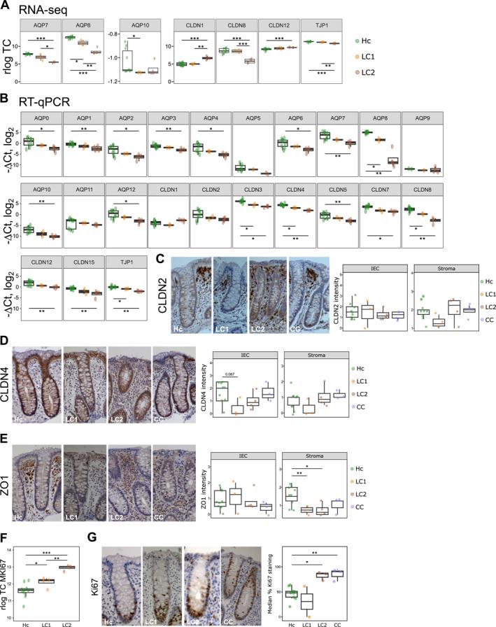 https://cdn.ncbi.nlm.nih.gov/pmc/blobs/f8fa/11250513/20a3035e58c9/UEG2-12-737-g002.jpg