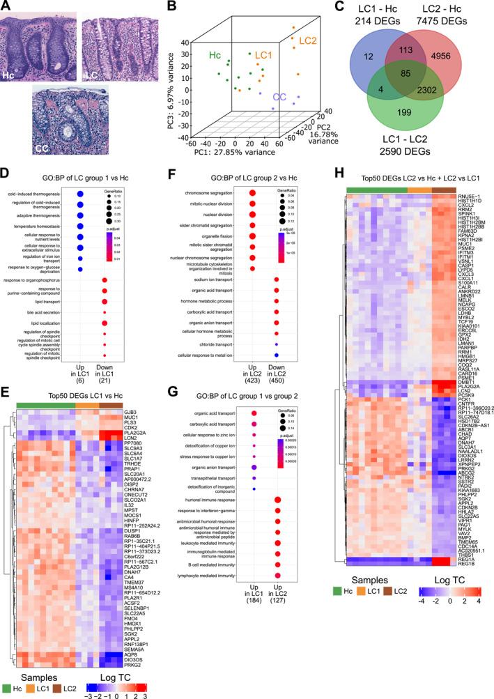 https://cdn.ncbi.nlm.nih.gov/pmc/blobs/f8fa/11250513/7520761ce803/UEG2-12-737-g003.jpg