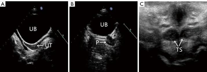 https://cdn.ncbi.nlm.nih.gov/pmc/blobs/f901/12332708/d30d99b71d1f/qims-15-08-7650-f6.jpg