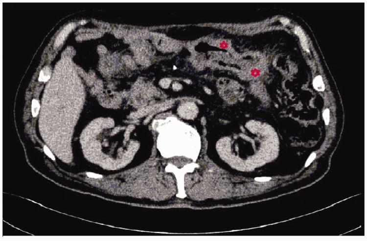 https://cdn.ncbi.nlm.nih.gov/pmc/blobs/f90a/8182193/bc6ba2d5b96c/10.1177_03000605211017037-fig4.jpg