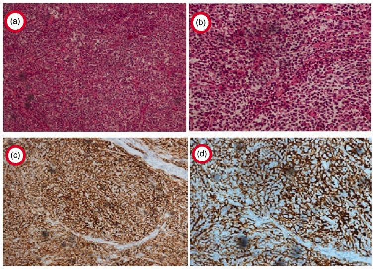 https://cdn.ncbi.nlm.nih.gov/pmc/blobs/f90a/8182193/d1e9c4f2e2e0/10.1177_03000605211017037-fig3.jpg