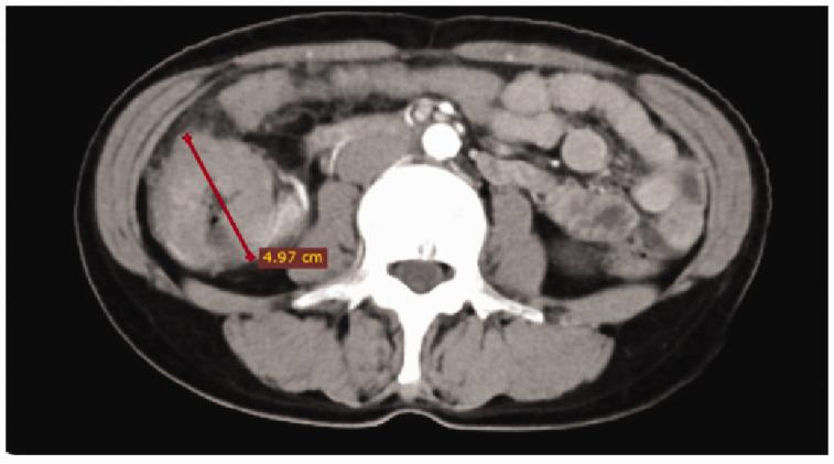 https://cdn.ncbi.nlm.nih.gov/pmc/blobs/f90a/8182193/e81e58b91a6d/10.1177_03000605211017037-fig2.jpg