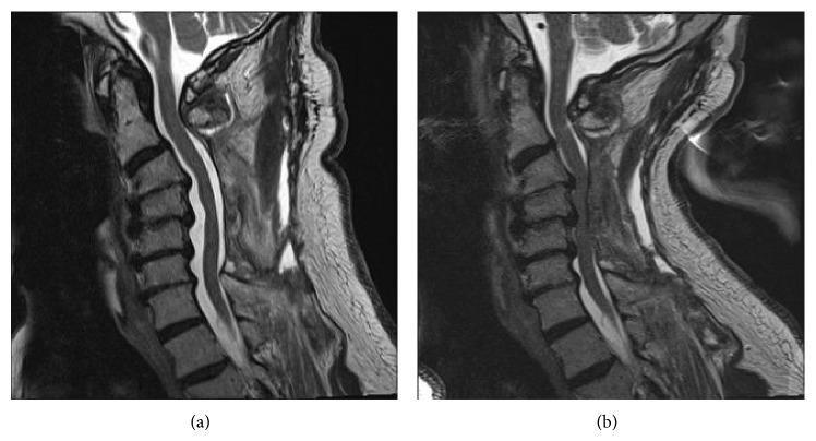 https://cdn.ncbi.nlm.nih.gov/pmc/blobs/f90c/4423003/57dcc3ed5631/CRIRA2015-275623.002.jpg