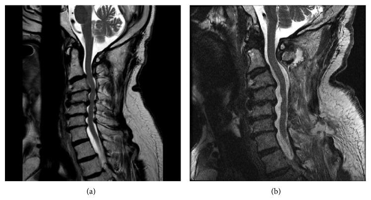 https://cdn.ncbi.nlm.nih.gov/pmc/blobs/f90c/4423003/689a68524b60/CRIRA2015-275623.001.jpg