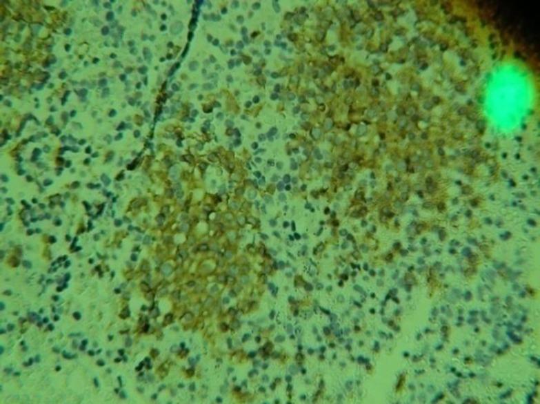 https://cdn.ncbi.nlm.nih.gov/pmc/blobs/f90e/4529683/9f0d81ff5fc0/IJHOSCR-9-157-g001.jpg