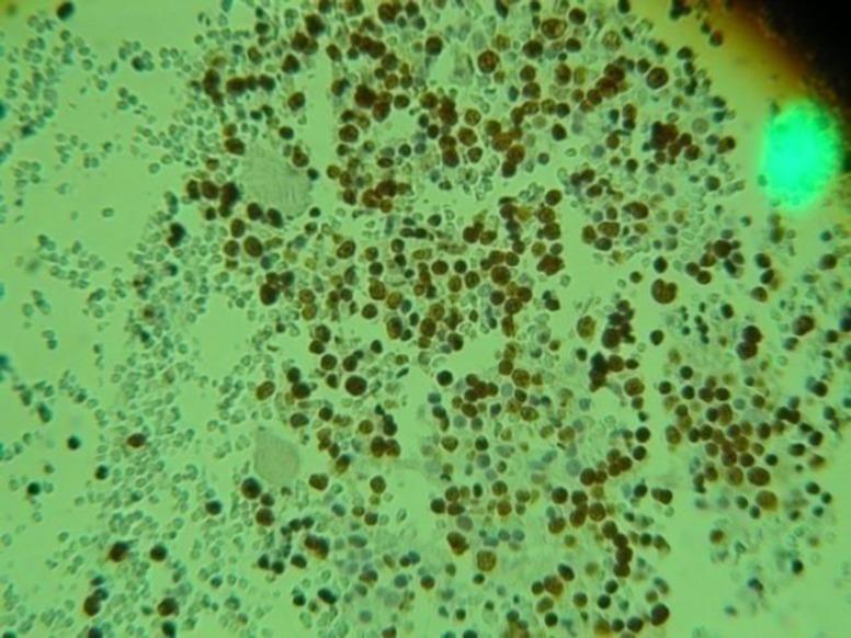 https://cdn.ncbi.nlm.nih.gov/pmc/blobs/f90e/4529683/ca94a9dd5751/IJHOSCR-9-157-g002.jpg