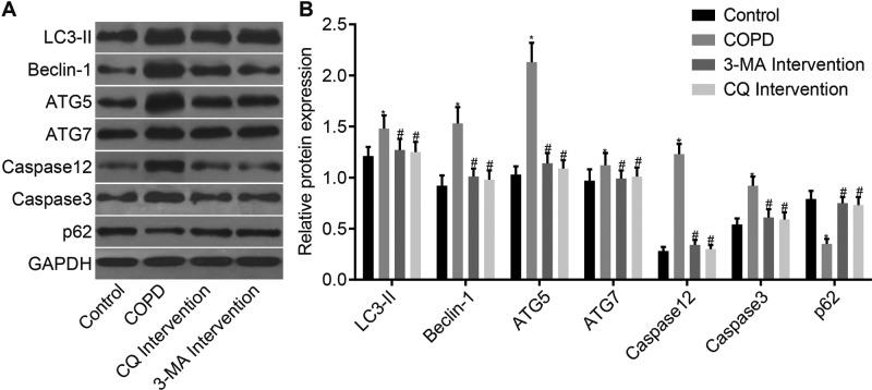 https://cdn.ncbi.nlm.nih.gov/pmc/blobs/f913/5686393/407ec9a8086b/bsr-37-bsr20170803-g4.jpg