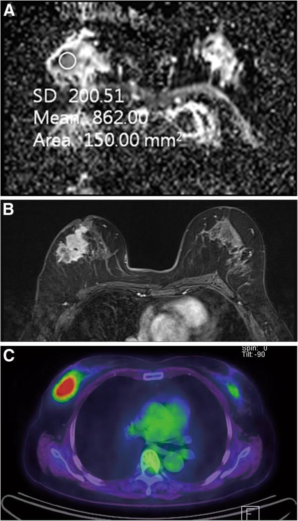 https://cdn.ncbi.nlm.nih.gov/pmc/blobs/f915/3443424/39dca66b6379/1477-7819-10-126-1.jpg