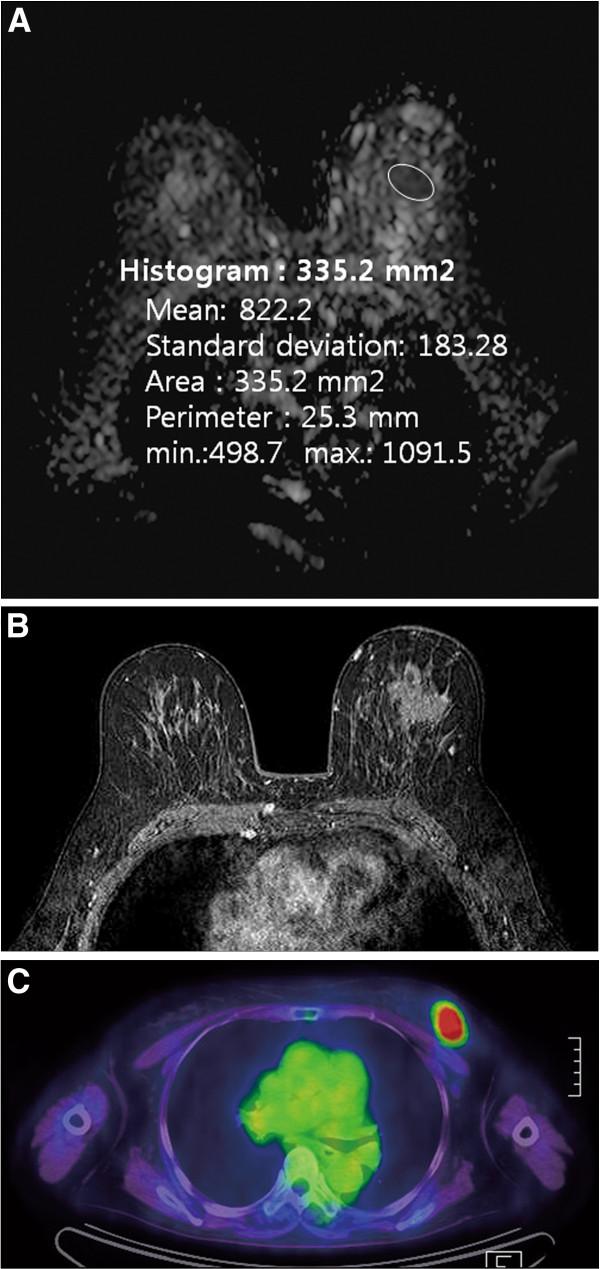 https://cdn.ncbi.nlm.nih.gov/pmc/blobs/f915/3443424/5987ffbbea96/1477-7819-10-126-2.jpg