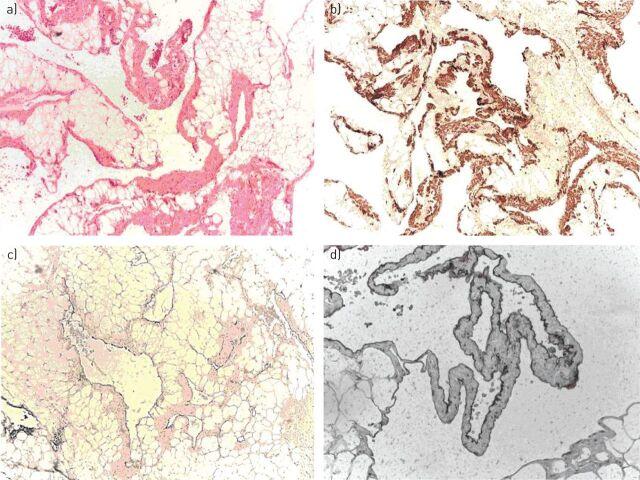 https://cdn.ncbi.nlm.nih.gov/pmc/blobs/f917/9487238/588b0484f4f6/ERR-0018-2016.01.jpg