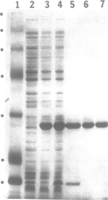 https://cdn.ncbi.nlm.nih.gov/pmc/blobs/f923/309433/1d7ca54e400d/nar00057-0232-a.jpg