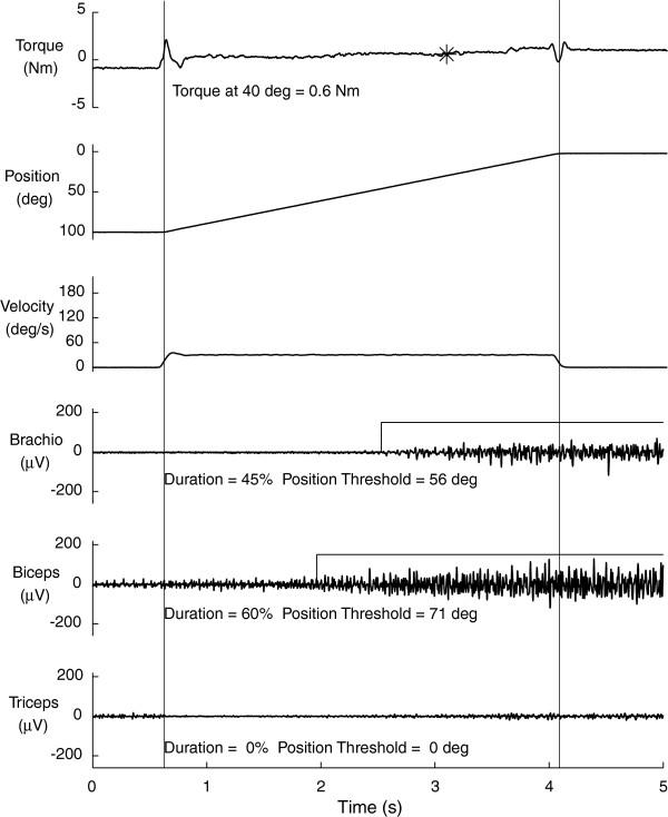 https://cdn.ncbi.nlm.nih.gov/pmc/blobs/f92a/3562202/4a1bf8cbb6a9/1743-0003-10-1-4.jpg