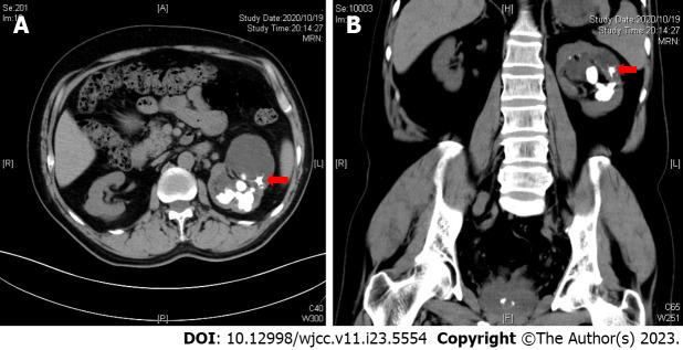 https://cdn.ncbi.nlm.nih.gov/pmc/blobs/f92f/10450386/6dcb3744c94c/WJCC-11-5554-g001.jpg