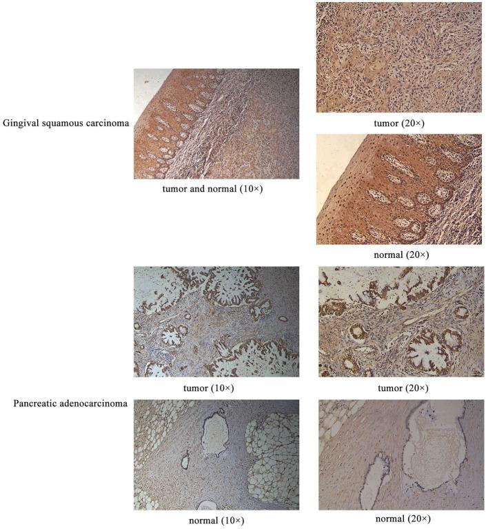 https://cdn.ncbi.nlm.nih.gov/pmc/blobs/f92f/7882720/4af89faad62c/fgene-12-620472-g0003.jpg