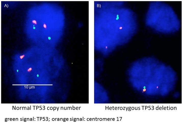 https://cdn.ncbi.nlm.nih.gov/pmc/blobs/f933/6403495/3ef8992a1dbb/ol-17-04-3826-g01.jpg