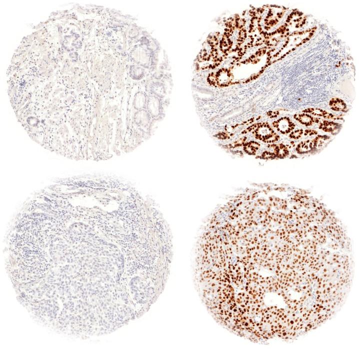 https://cdn.ncbi.nlm.nih.gov/pmc/blobs/f933/6403495/c2b18a308ead/ol-17-04-3826-g00.jpg