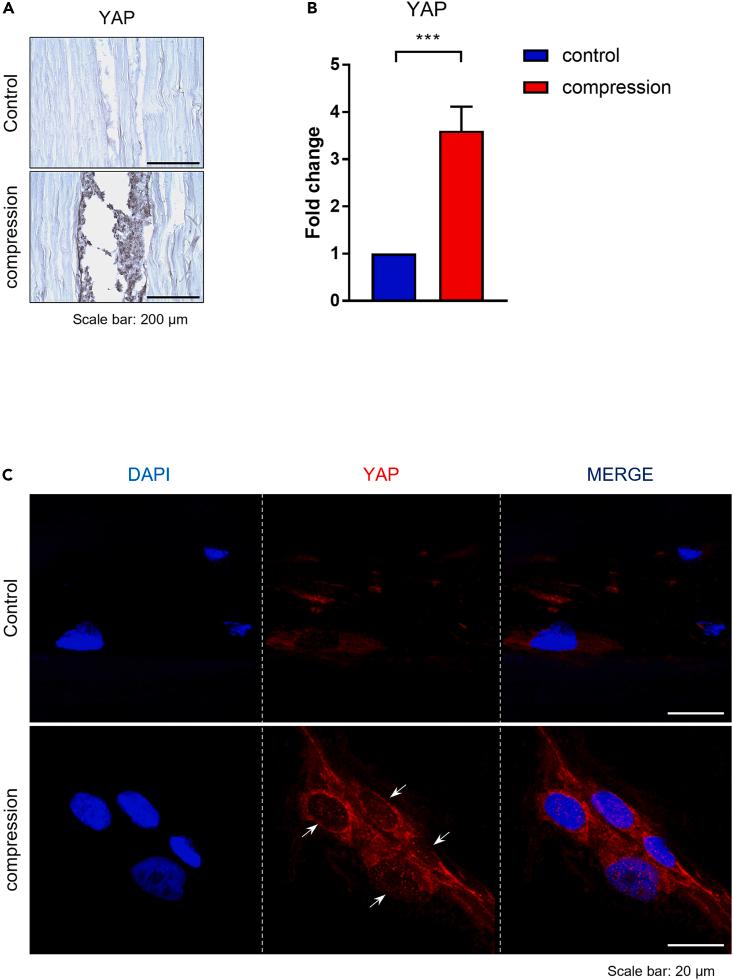 https://cdn.ncbi.nlm.nih.gov/pmc/blobs/f938/10755058/614cfae4da70/gr3.jpg