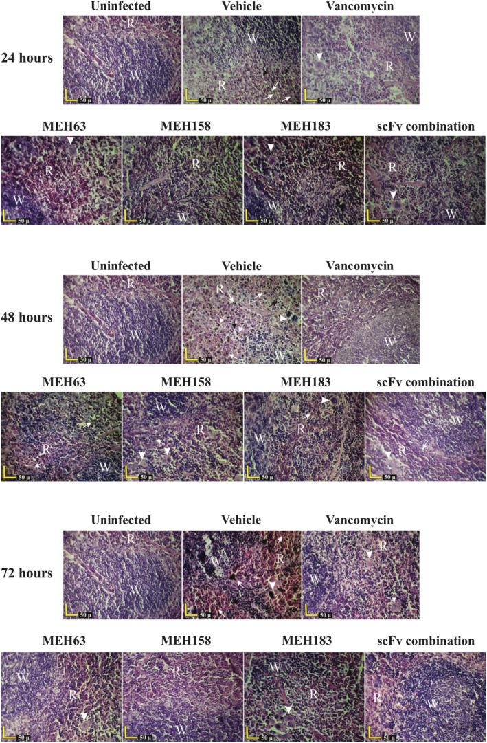 https://cdn.ncbi.nlm.nih.gov/pmc/blobs/f939/8240403/1bc3df3d4fef/CTI2-10-e1302-g009.jpg