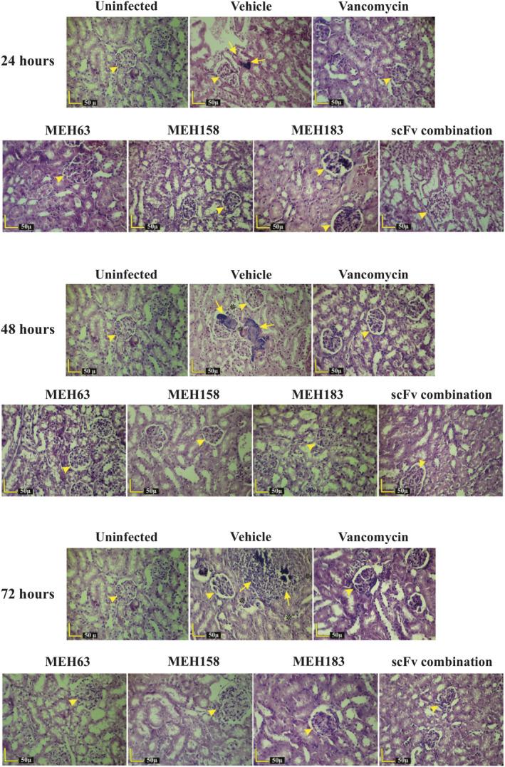 https://cdn.ncbi.nlm.nih.gov/pmc/blobs/f939/8240403/5bcf9c8d958e/CTI2-10-e1302-g003.jpg