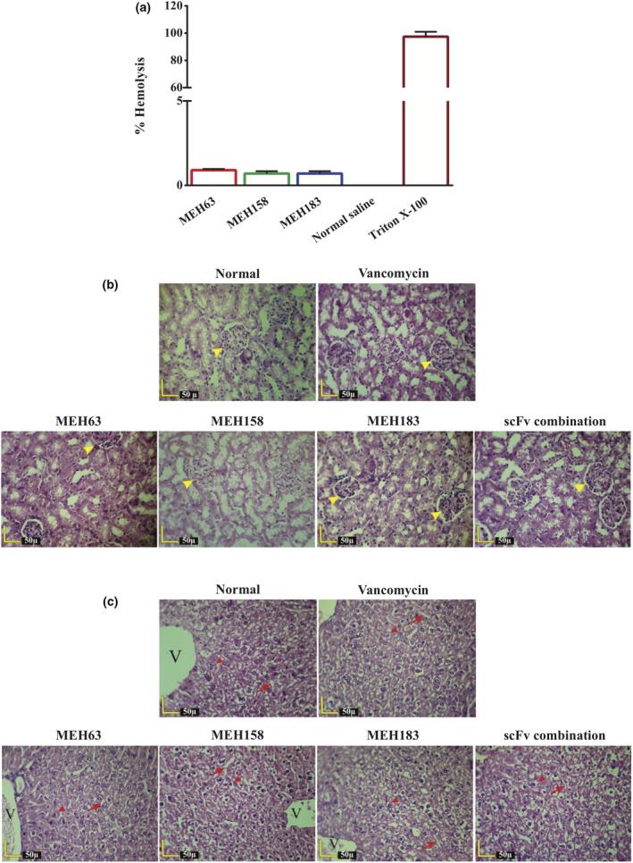 https://cdn.ncbi.nlm.nih.gov/pmc/blobs/f939/8240403/5fb079000710/CTI2-10-e1302-g002.jpg