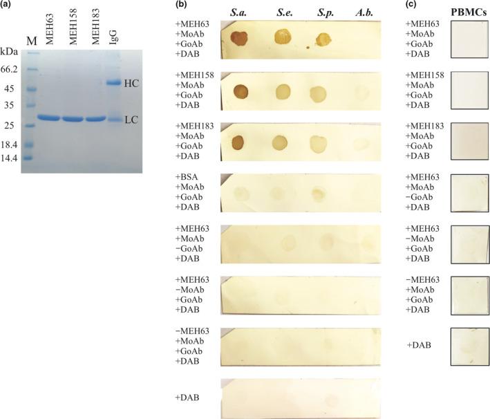 https://cdn.ncbi.nlm.nih.gov/pmc/blobs/f939/8240403/7dc2a924cb7f/CTI2-10-e1302-g005.jpg