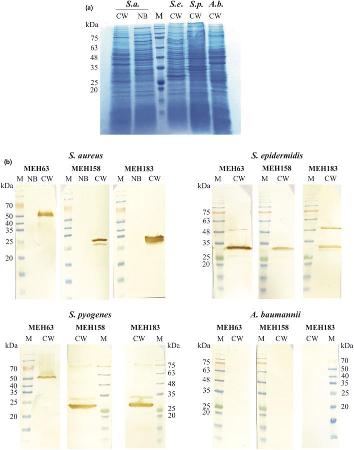 https://cdn.ncbi.nlm.nih.gov/pmc/blobs/f939/8240403/c1326c0125cc/CTI2-10-e1302-g001.jpg