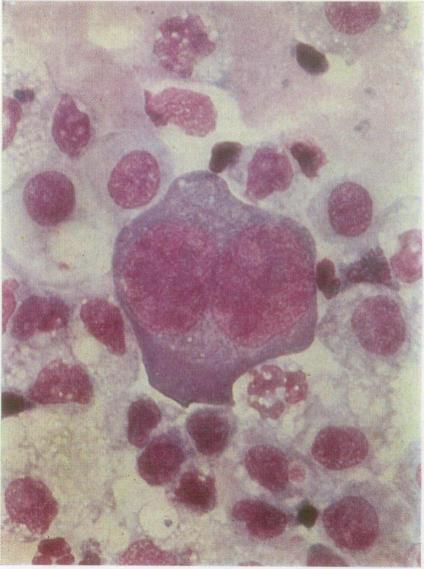 https://cdn.ncbi.nlm.nih.gov/pmc/blobs/f93e/494587/c71100deeba2/jclinpath00493-0010-d.jpg