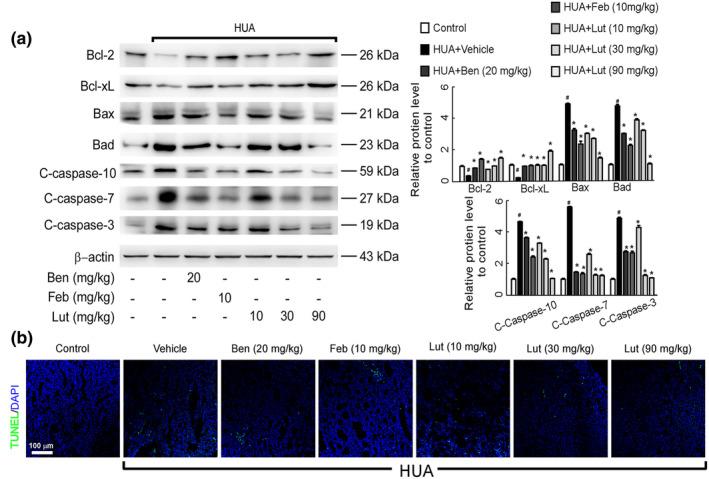 https://cdn.ncbi.nlm.nih.gov/pmc/blobs/f944/11521689/4ddb2d335b7d/FSN3-12-8053-g001.jpg