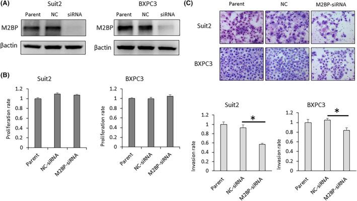 https://cdn.ncbi.nlm.nih.gov/pmc/blobs/f945/11007056/3e8bdb0cda4f/CAS-115-1241-g002.jpg